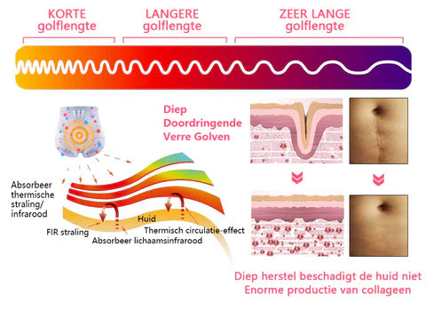 Medical magnetic ion fiber self-heating shaping shorts