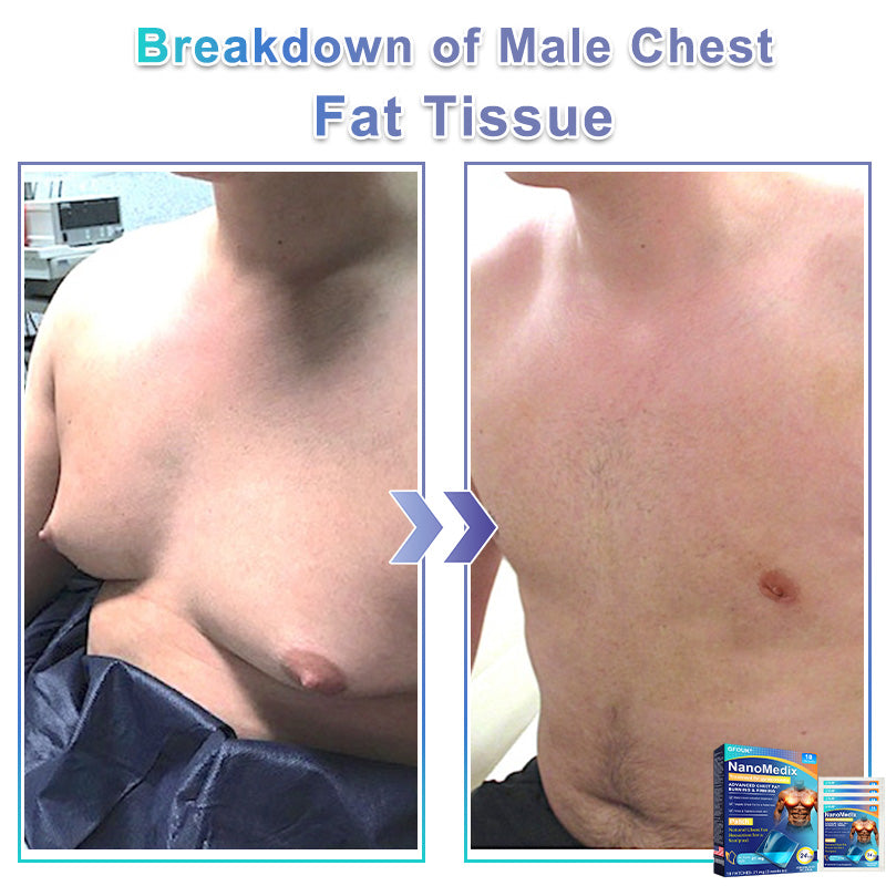 Wordking® NanoMedix Gynecomastia Chest Fatburn & Firm Patch