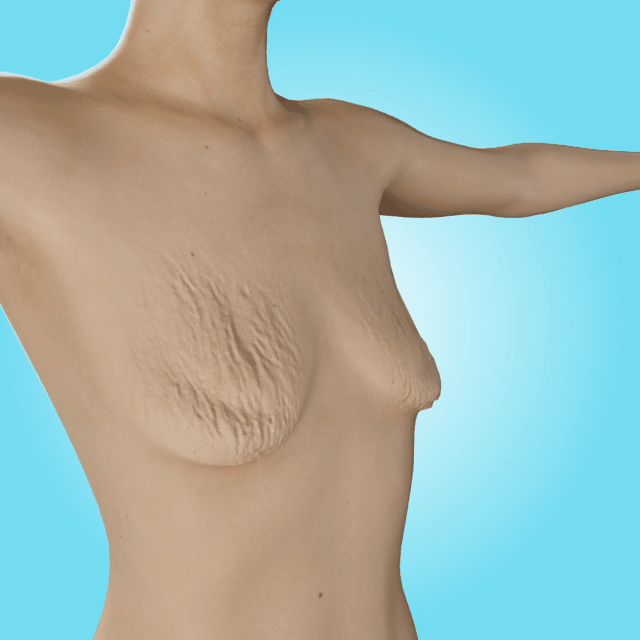 Wordkingยฎ Royal Jelly Breast Enhancement Patch ๐ Safe for use during breastfeeding (For concerns such as underdeveloped breasts, sagging, flatness, skin creases, and darkened nipples)