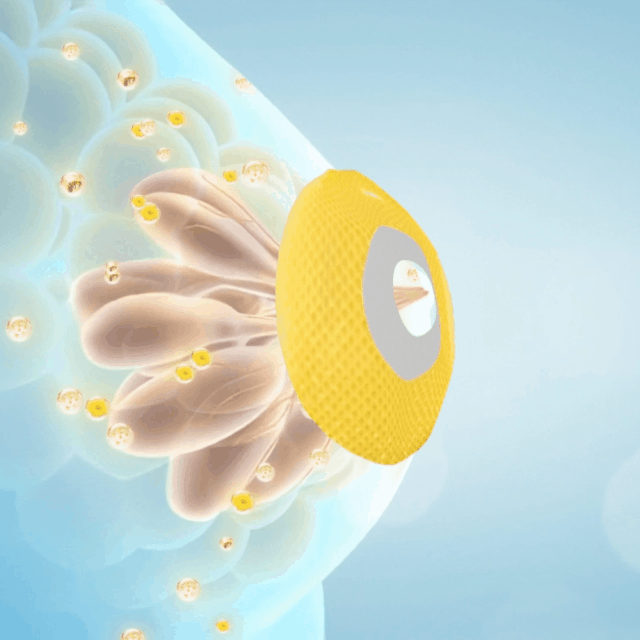 Wordkingยฎ Royal Jelly Breast Enhancement Patch ๐ Safe for use during breastfeeding (For concerns such as underdeveloped breasts, sagging, flatness, skin creases, and darkened nipples)
