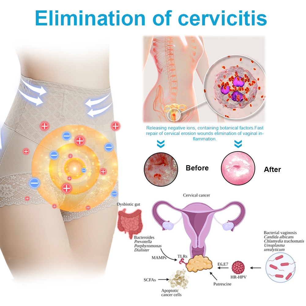 Medical magnetic ion fiber self-heating shaping shorts