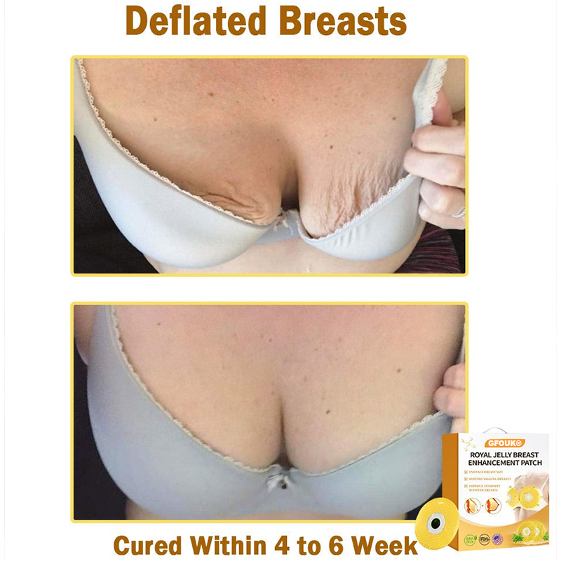 Wordkingยฎ Royal Jelly Breast Enhancement Patch ๐ Safe for use during breastfeeding (For concerns such as underdeveloped breasts, sagging, flatness, skin creases, and darkened nipples)