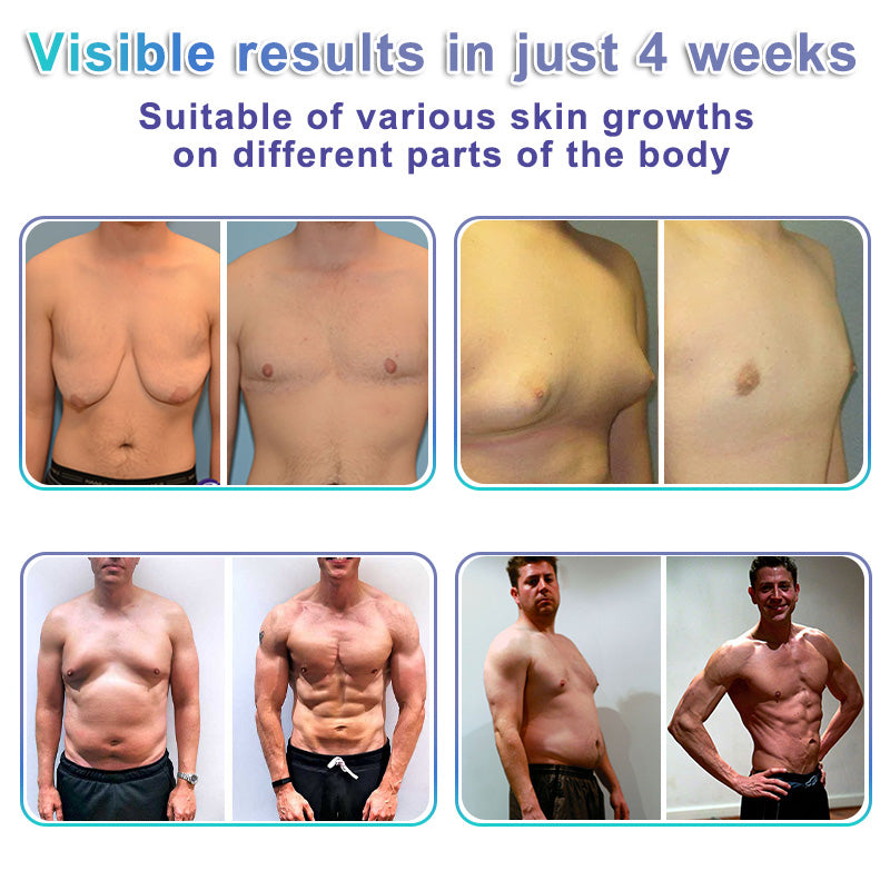 Wordking® NanoMedix Gynecomastia Chest Fatburn & Firm Patch