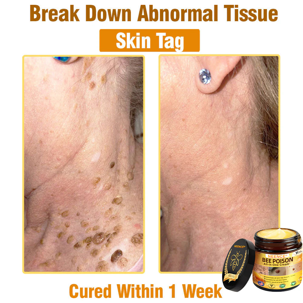 NEENC® Bee Poison All-in-One Cream US Dermatologist Approved