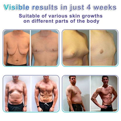 Wordking® NanoMedix Gynecomastia Chest Fatburn & Firm Patch