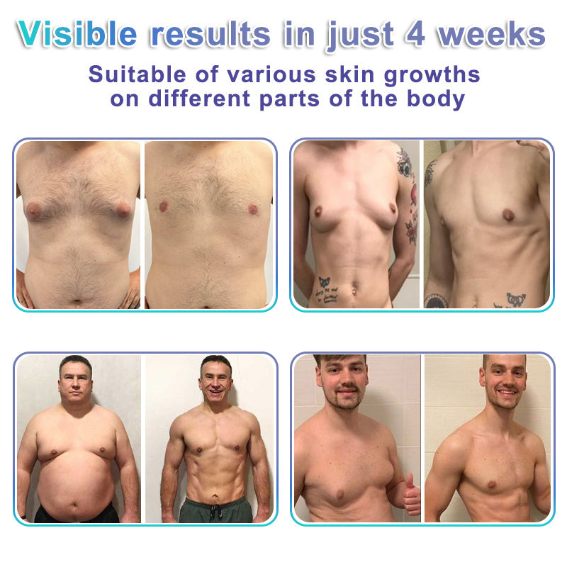Wordking® NanoMedix Gynecomastia Chest Fatburn & Firm Patch