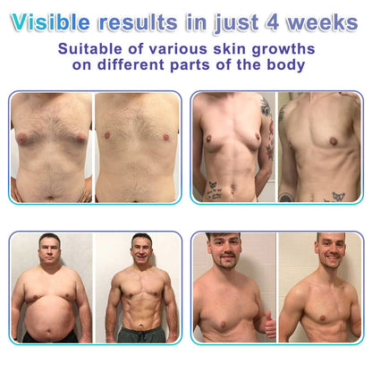Wordking® NanoMedix Gynecomastia Chest Fatburn & Firm Patch